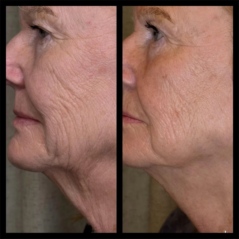 Skin Games recognition for Heather Byrne Cuevas of Skin Cove